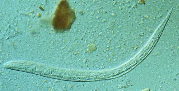 Strongyloides larva